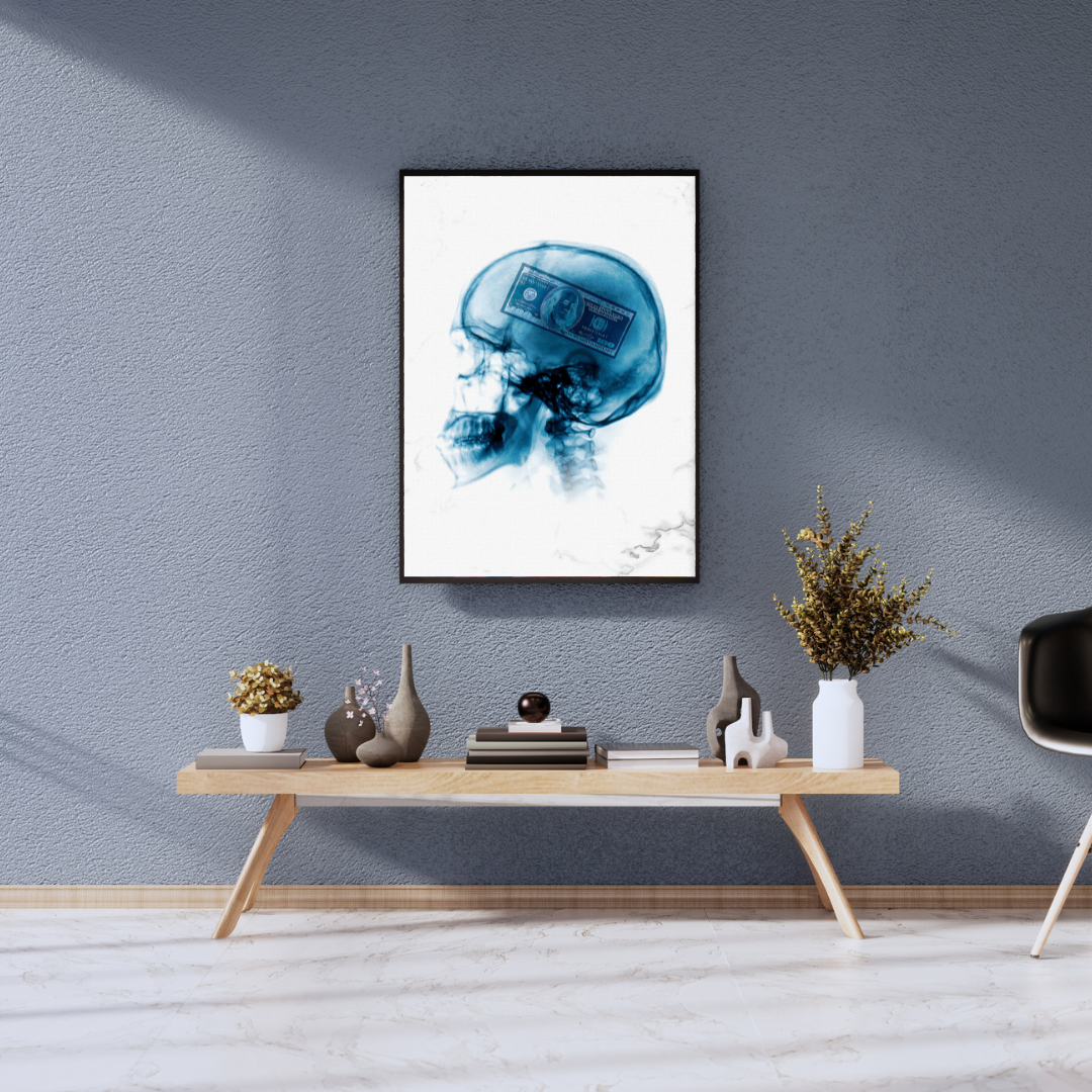 Money on My Mind – X-Ray Edition