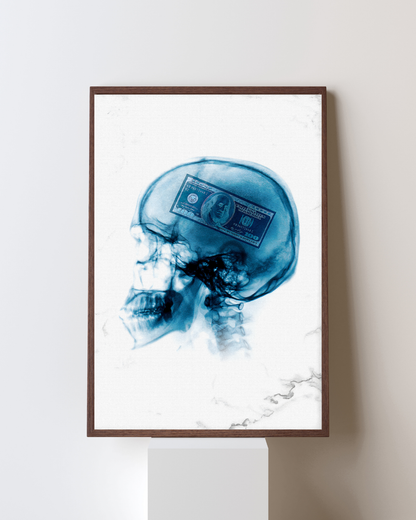 Money on My Mind – X-Ray Edition