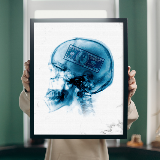 Money on My Mind – X-Ray Edition